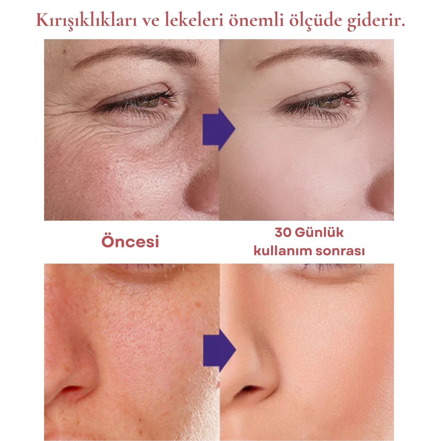 DermaRay Pro™ : Gençleştirici Işık Terapi Cihazı