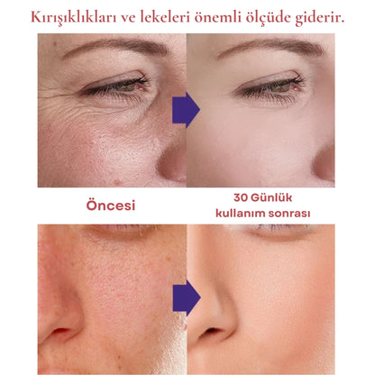 DermaRay Pro™ : Gençleştirici Işık Terapi Cihazı